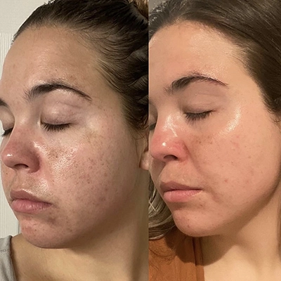 zoskincare